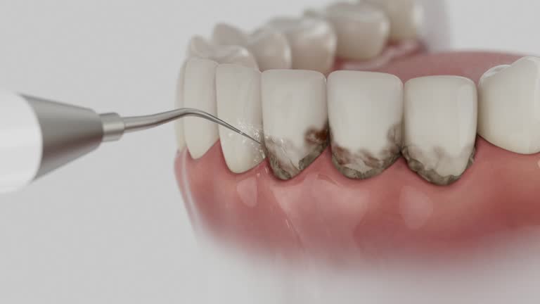Reliable Emergency Dentist contractor in Wahneta, FL by Smile Center Dentistry